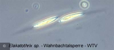 1219299689Elakatothrix_sp - Chlorophyta Ulvophyceae Ulotrichales Elakatothrix sp.