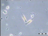 Dinobryon_suecicum_1235745500