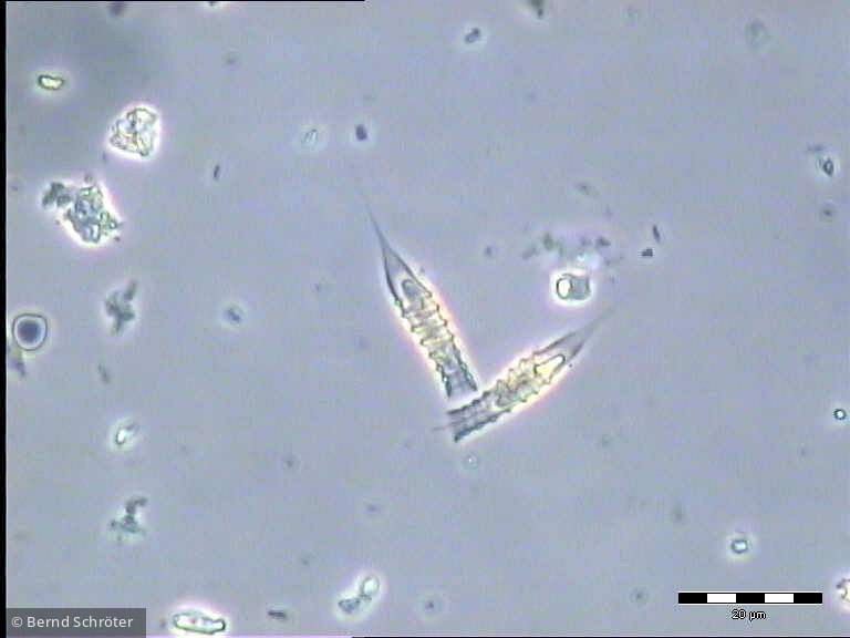 Dinobryon_suecicum_1235745500 - Heterocontophyta Chrysophyceae Ochromonadales Dinobryon suecicum
