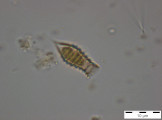 Dinobryon_suecicum_1255594109