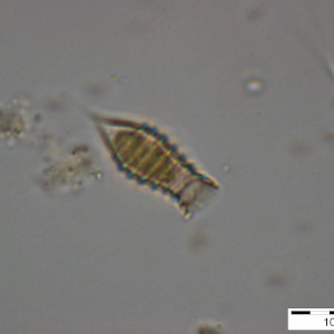 Dinobryon_suecicum_1255594109