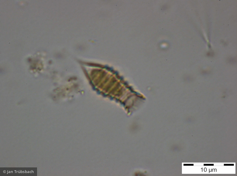 Dinobryon_suecicum_1255594109 - Heterocontophyta Chrysophyceae Ochromonadales Dinobryon suecicum