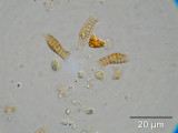 Dinobryon_suecicum_1260795216