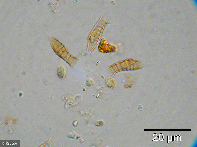 Dinobryon_suecicum_1260795216 - Heterocontophyta Chrysophyceae Ochromonadales Dinobryon suecicum