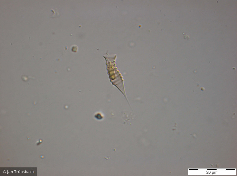 Heterocontophyta Chrysophyceae Ochromonadales Dinobryon suecicum
