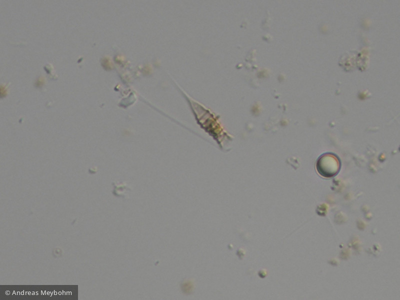 Dinobryon_suecicum_1253889746 - Heterocontophyta Chrysophyceae Ochromonadales Dinobryon suecicum