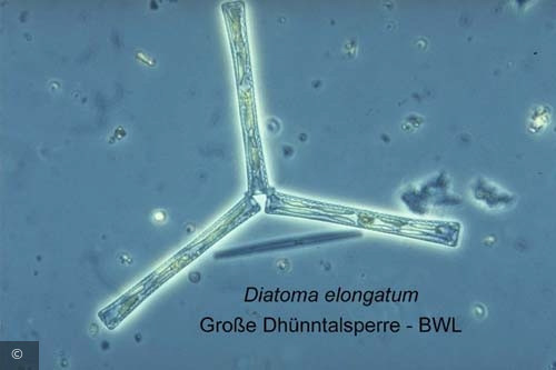 Diatoma tenuis · Heterocontophyta Bacillariophyceae Pennales · 1219402129Diatoma_elongatum_ATT