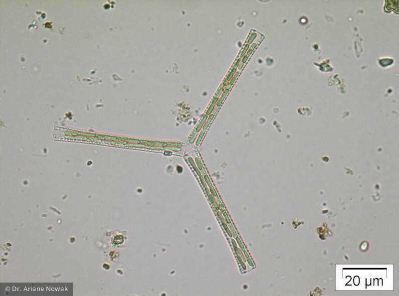 Diatoma tenuis · Heterocontophyta Bacillariophyceae Pennales · 400fachx