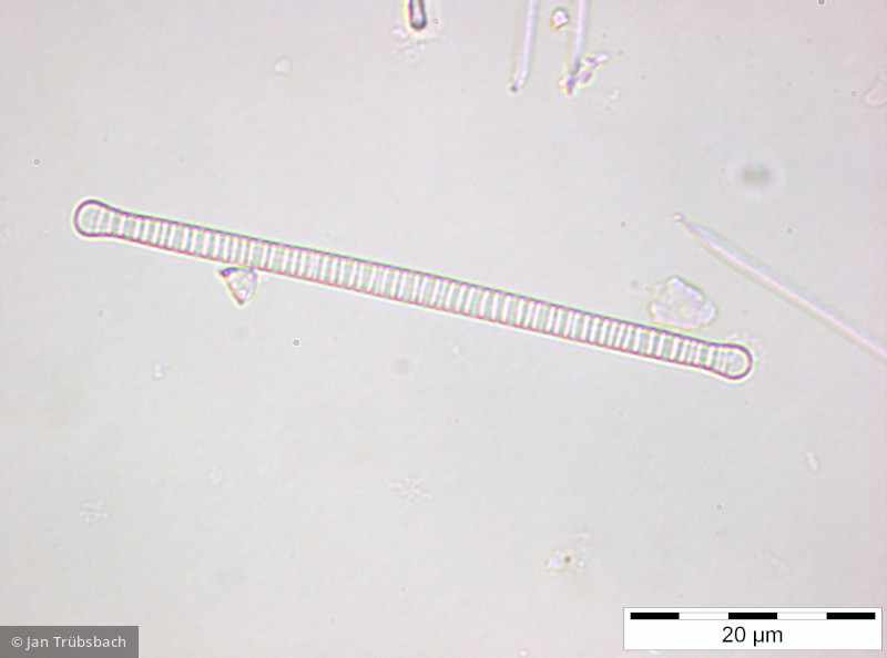 Diatoma tenuis · Heterocontophyta Bacillariophyceae Pennales · 1000x