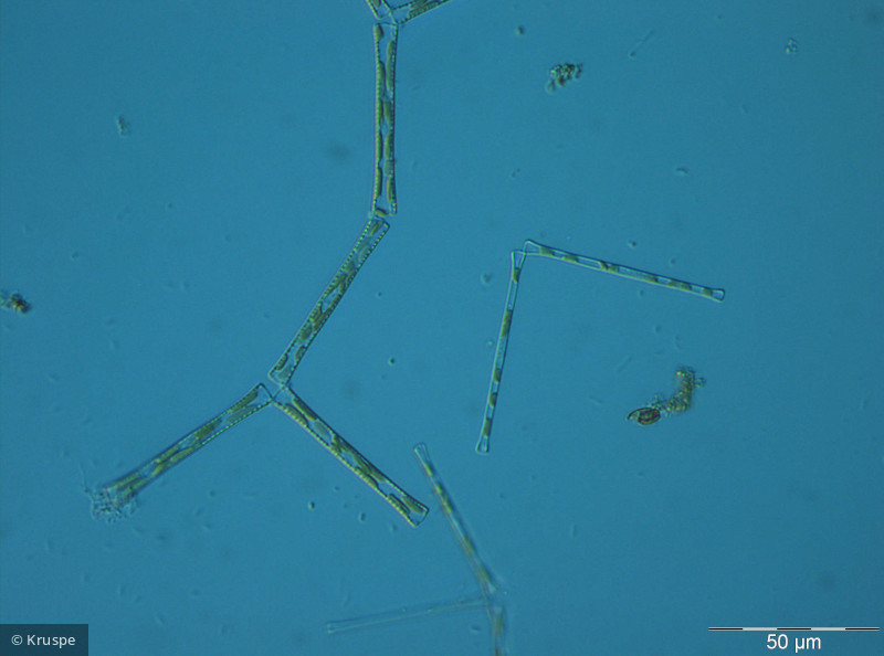 Diatoma tenuis · Heterocontophyta Bacillariophyceae Pennales · 400x