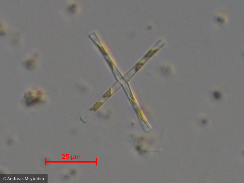 Diatoma tenuis · Heterocontophyta Bacillariophyceae Pennales · 1000x