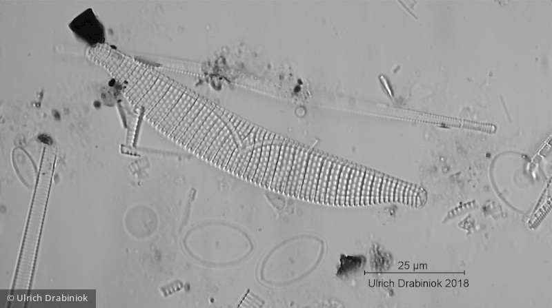 Heterocontophyta Bacillariophyceae Pennales Epithemia turgida