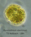 Gymnodinium_uberrimum_1219909450