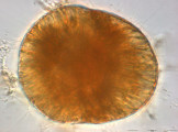 Gymnodinium_uberrimum_1219910191
