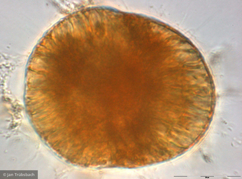 Gymnodinium_uberrimum_1219910191 - Dinophyta Dinophyceae Peridiniales Gymnodinium uberrimum