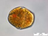 Gymnodinium_uberrimum_1249914362