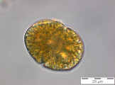Gymnodinium_uberrimum_1249914449