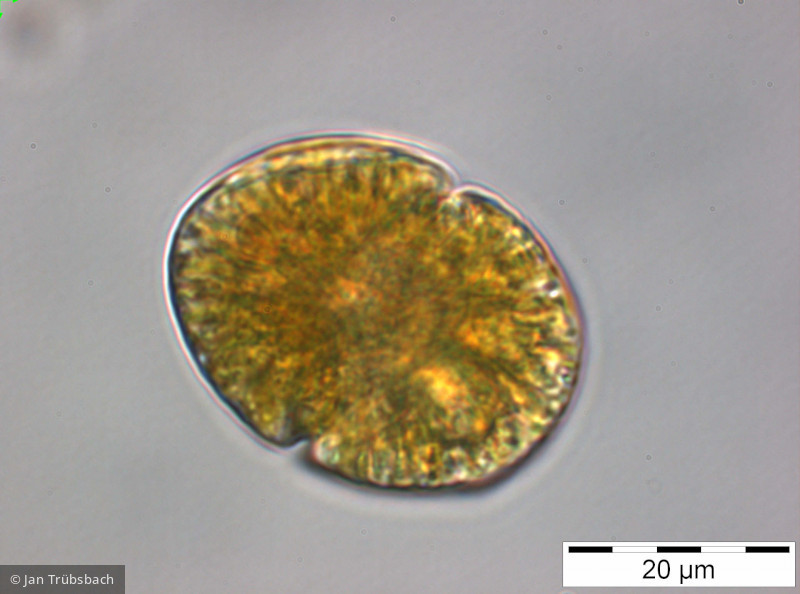 Gymnodinium_uberrimum_1249914449 - Dinophyta Dinophyceae Peridiniales Gymnodinium uberrimum