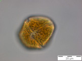 Gymnodinium_uberrimum_1249914534