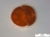 Gymnodinium_uberrimum_1249970719