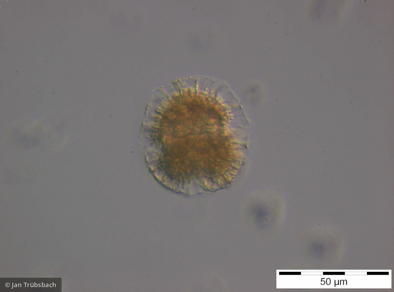 Gymnodinium_uberrimum_1253714987 - Dinophyta Dinophyceae Peridiniales Gymnodinium uberrimum