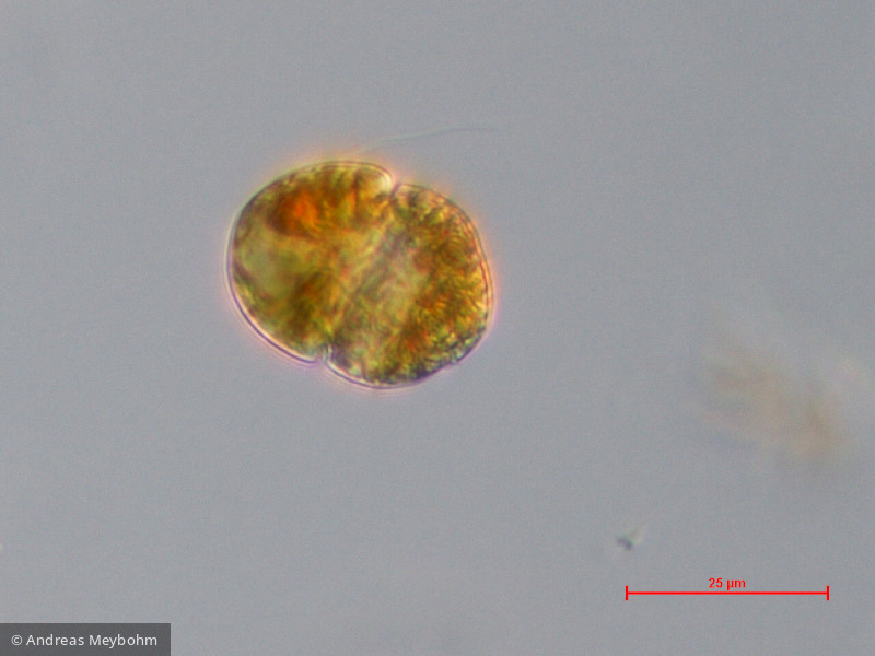 Dinophyta Dinophyceae Peridiniales Gymnodinium uberrimum