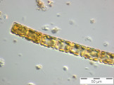 Melosira_varians_1229415649