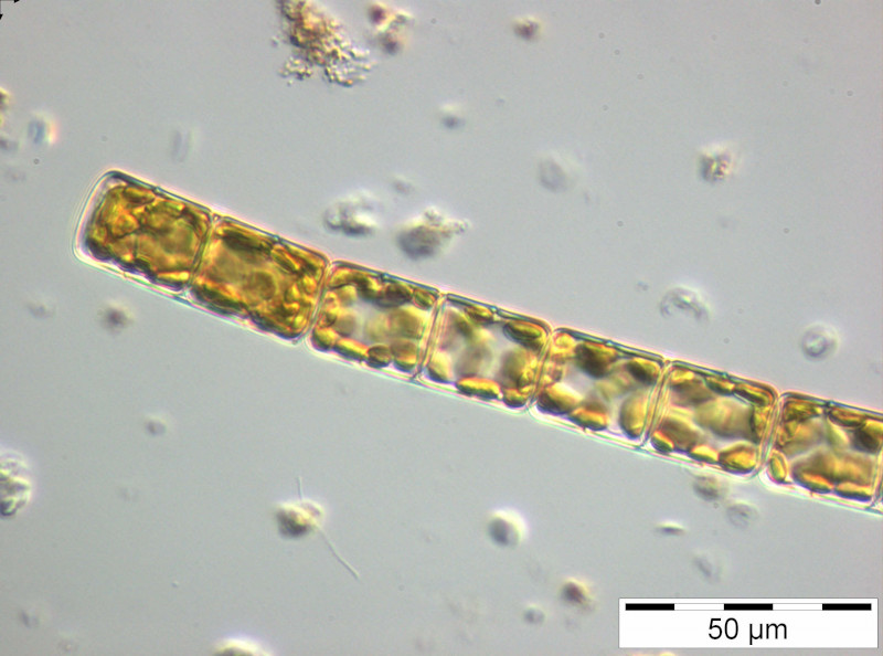 Melosira_varians_1229415649 - Heterocontophyta Bacillariophyceae Centrales Melosira varians
