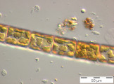 Melosira_varians_1229415856
