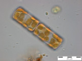 Melosira_varians_1255349148