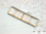 Melosira_varians_1259584147