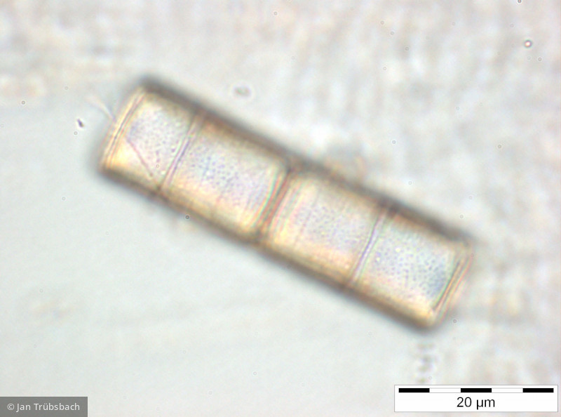 Melosira_varians_1259584147 - Heterocontophyta Bacillariophyceae Centrales Melosira varians