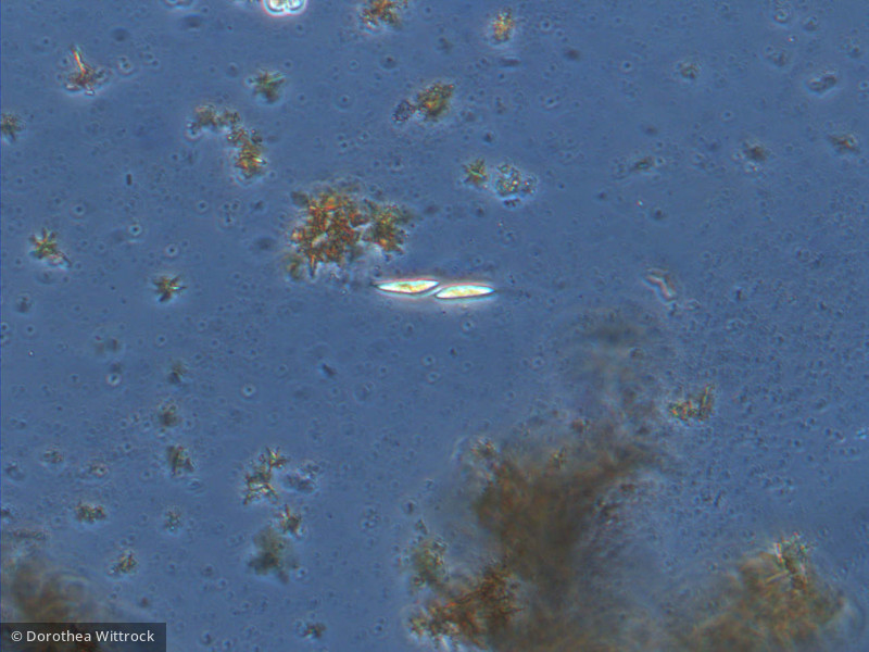 Chlorophyta Ulvophyceae Ulotrichales Fusola viridis