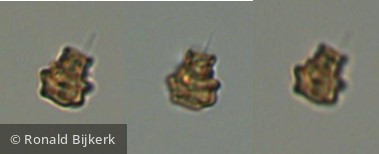 Heterocontophyta Chrysophyceae Chromulinales Kephyrion welshii