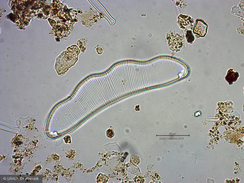 Heterocontophyta Bacillariophyceae Pennales Eunotia zygodon