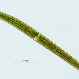 Closterium directum