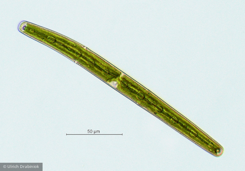 Chlorophyta Conjugatophyceae Desmidiales Closterium directum