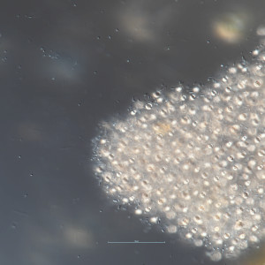 Microcystis aeruginosa