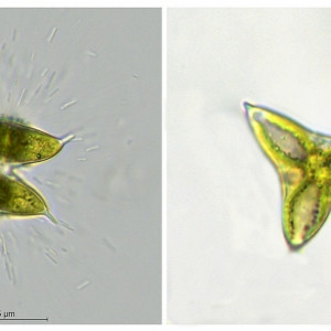 Staurodesmus dejectus