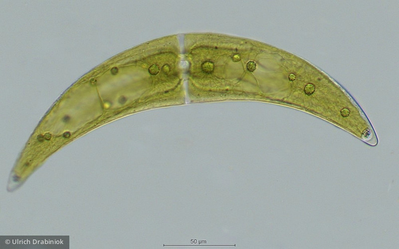 Chlorophyta Conjugatophyceae Desmidiales Closterium moniliferum