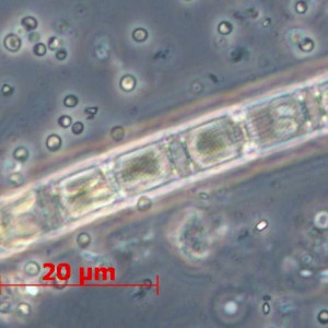 Aulacoseira subarctica