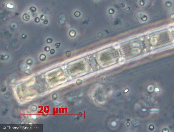 Aulacoseira subarctica &middot; Heterocontophyta Bacillariophyceae Centrales &middot; 1000x