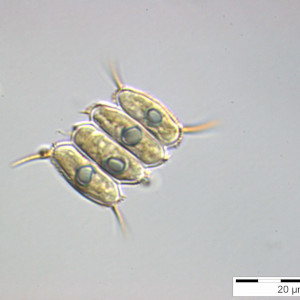 Scenedesmus_cf. armatus_1256297824