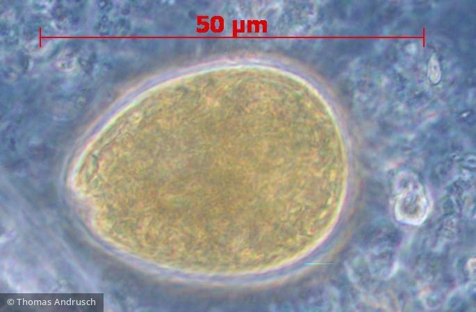 Euglenophyta Euglenophyceae Euglenales Euglena texta