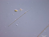 Raphidiopsis_mediteranea_1237284435
