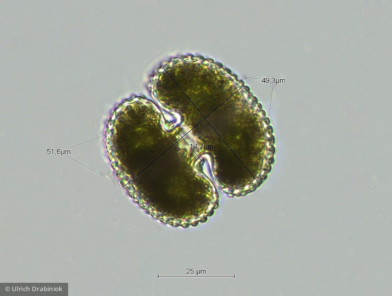 Cosmarium reniforme · Chlorophyta Conjugatophyceae Desmidiales