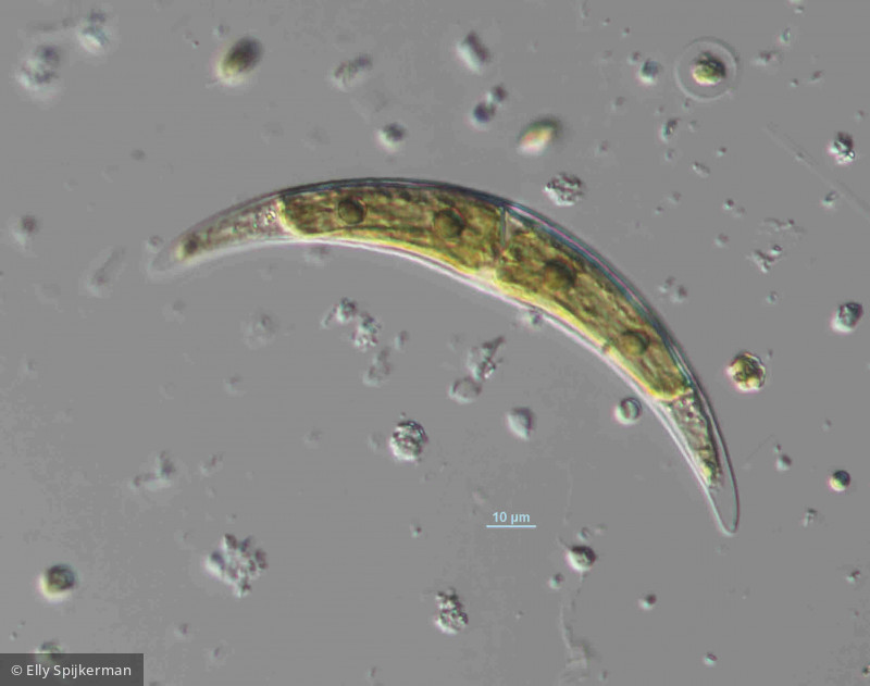 Chlorophyta Conjugatophyceae Desmidiales Closterium moniliferum