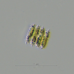 Desmodesmus serratus