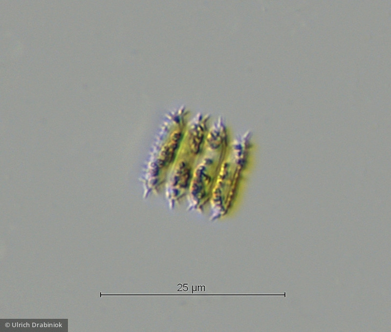 Chlorophyta Chlorophyceae Chlorococcales Desmodesmus serratus