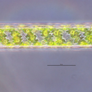 Spirogyra sp.